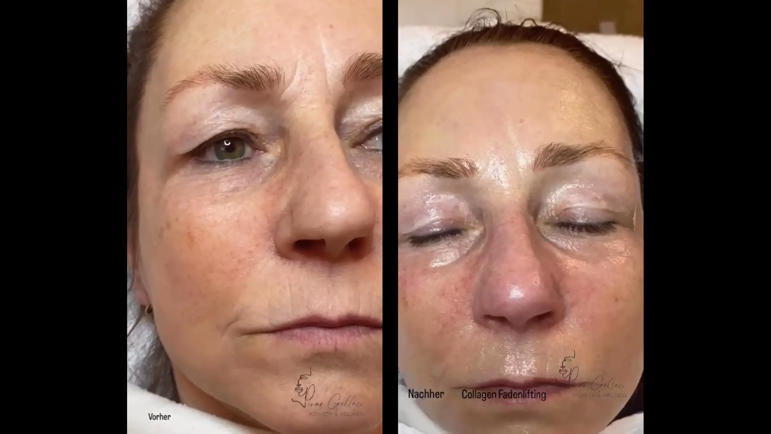 Voorbeeldafbeelding voor de video