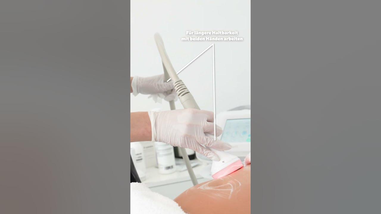 Voorbeeldafbeelding voor de video