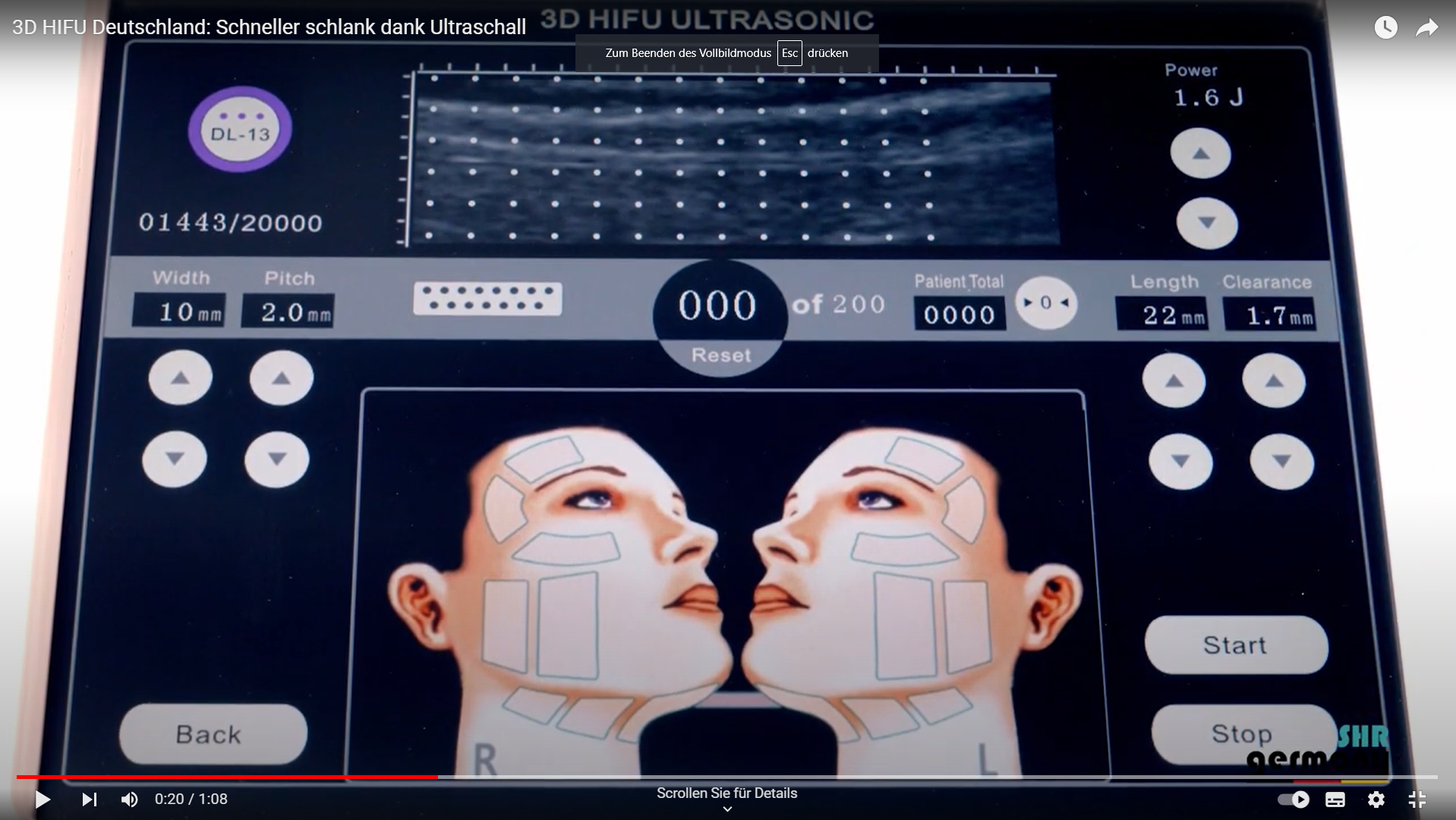 Voorbeeldafbeelding voor de video