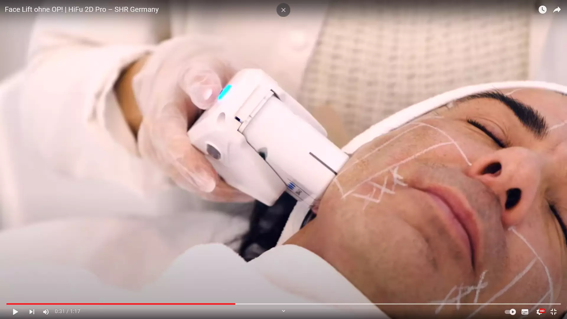 Voorbeeldafbeelding voor de video